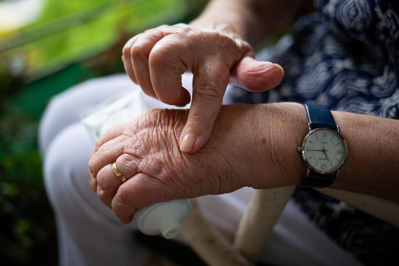 H&auml;nde mit sichtbaren Gelenkver&auml;nderungen bei rheumatoider Arthritis